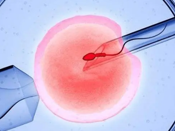 胚胎移植后第17天出血是生化妊娠还是异位妊娠？