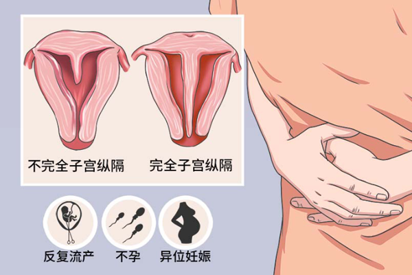 纵隔子宫的危害除了反复流产还有什么？