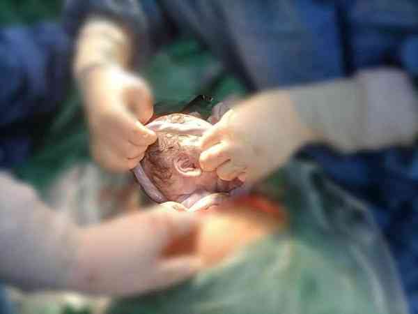 脐带绕颈三周胎儿会有缺氧死亡的危险吗？