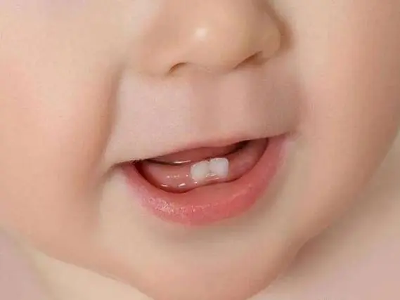 小朋友乳牙换恒牙的年纪是岁到几岁？
