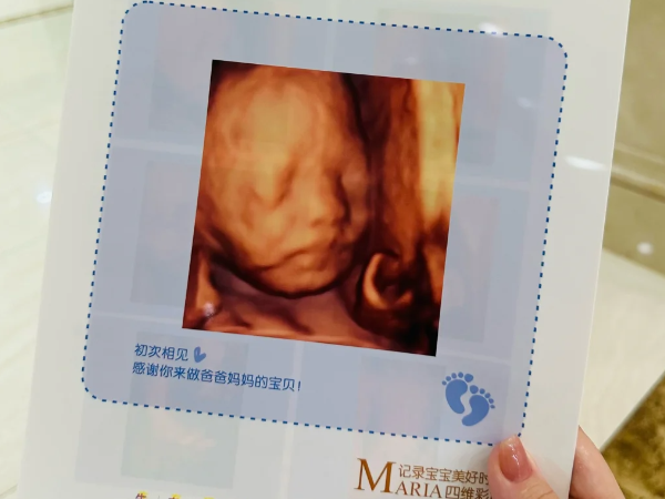 孕17周做四维彩超能看清楚胎儿的容貌五官吗？