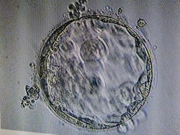 移植冻胚只看子宫内膜厚度是否满足条件吗？