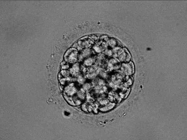 胚胎移植第一次和第二次感觉不一样正常吗？