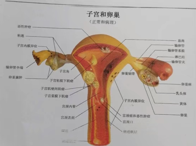 平时痛经厉害会是不孕的症状表现吗？