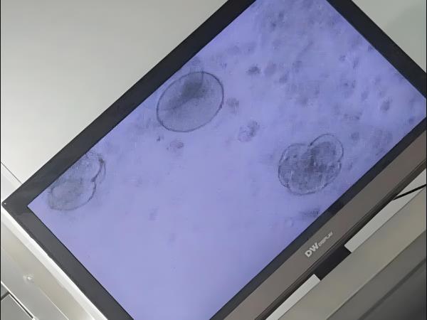 国内做三代试管婴儿生一对龙凤胎收费价格贵吗？