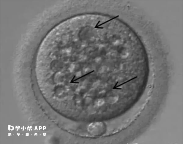 胚胎透明带可以保护胚胎