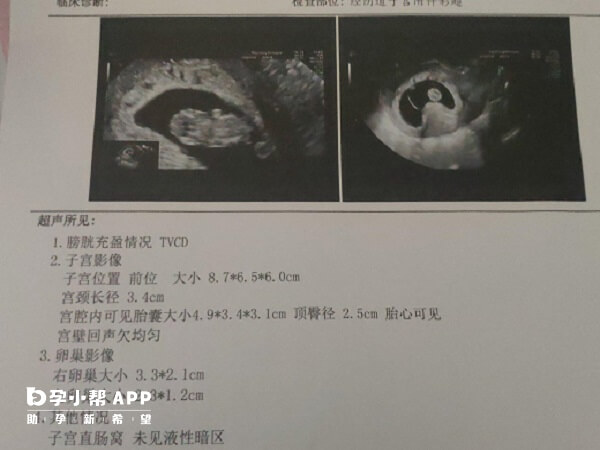 在怀孕40天左右宫腔内会出现孕囊
