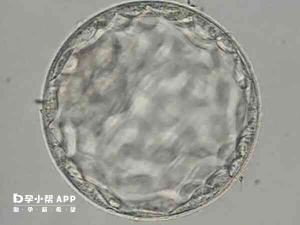 囊胚移植可以减少染色体异常问题
