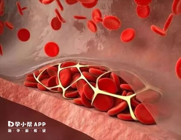 长时间卧床容易导致血栓