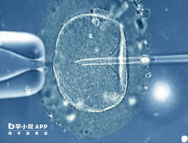 月经期取卵可能会造成盆腔感染