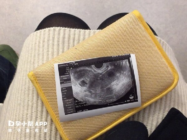 怀孕六周的时候胚胎发育很迅速了