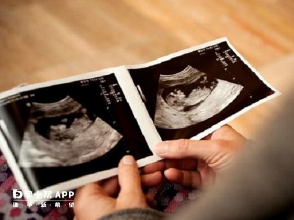胎儿在第19周最大的变化就是感觉器官开始按照区域迅速的发展