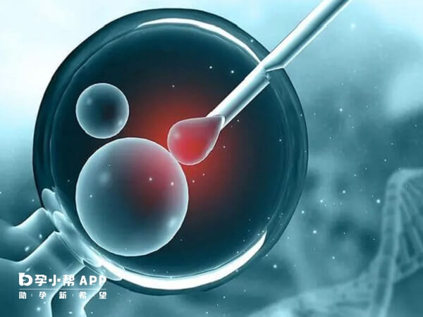 第二代试管婴儿是人工注入卵子会对精子内部造成损伤