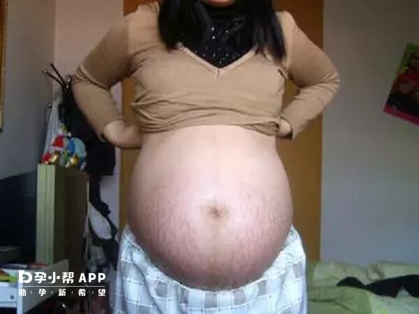 生男孩的孕妇肚子一般都是比较靠下的