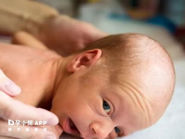 新生宝宝的皮脂腺较薄会呈现出略显沧桑的模样