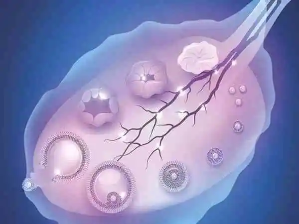 卵泡成熟后如果不能及时破裂排出主要的原因是内分泌紊乱引起