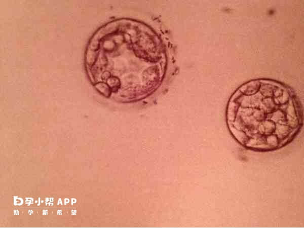 第五天的4ab囊胚属于优质胚胎