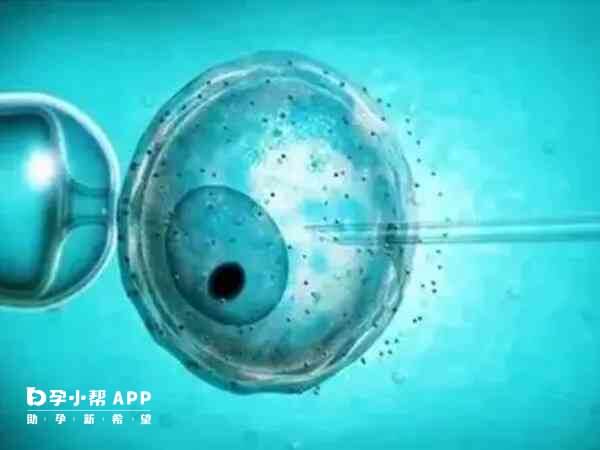 胚胎移植可在十分钟内完成