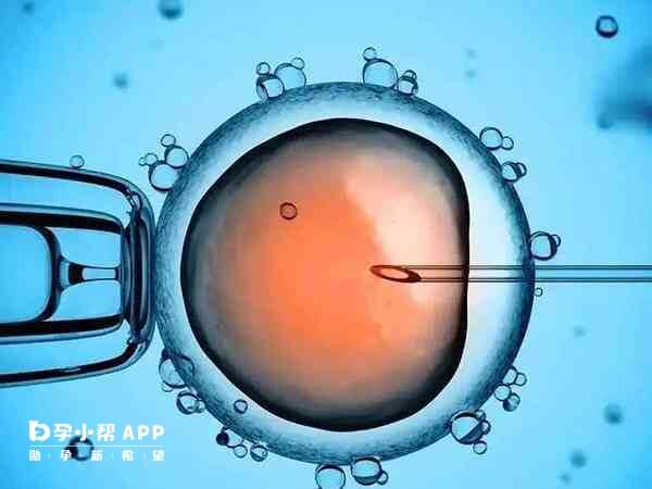 精子异常会导致二代试管受精异常