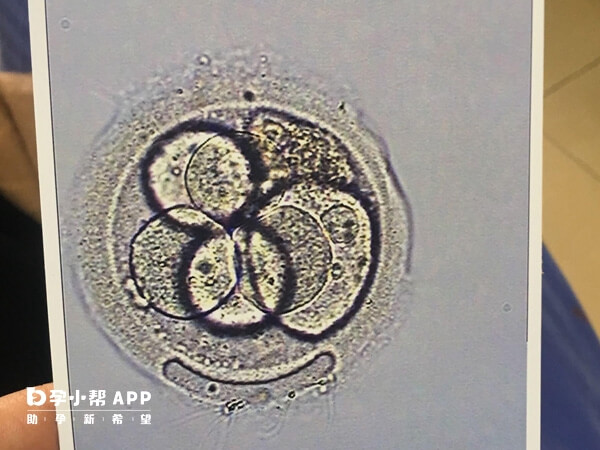 胚胎自身原因会导致发育不良
