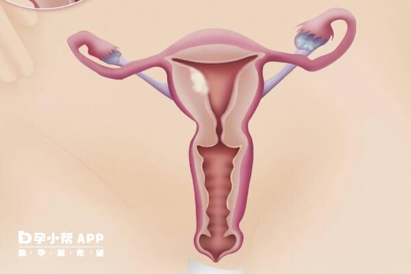 女性吃补佳乐有促进子宫内膜生长的作用