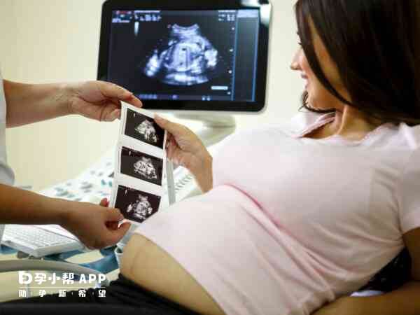 NT有助于早期发现胎儿畸形