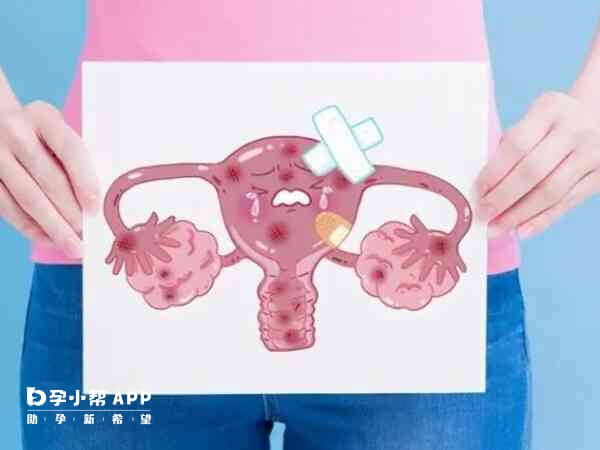 子宫内膜过薄会影响生育