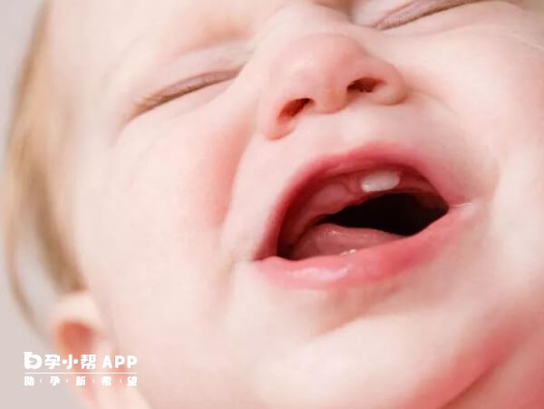 宝宝长牙时牙床可能会有疼痛