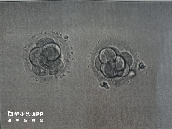 剩余胚胎有三种处理方法