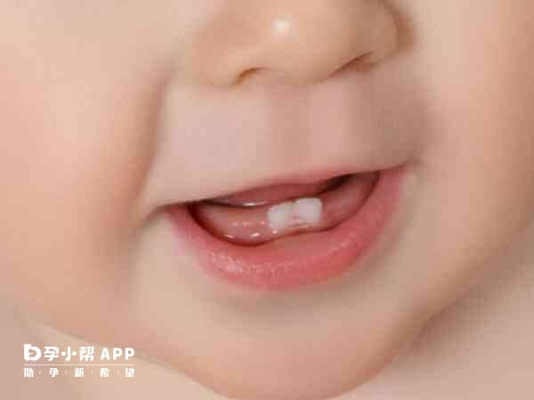 长牙会引起牙龈组织轻度肿胀不适