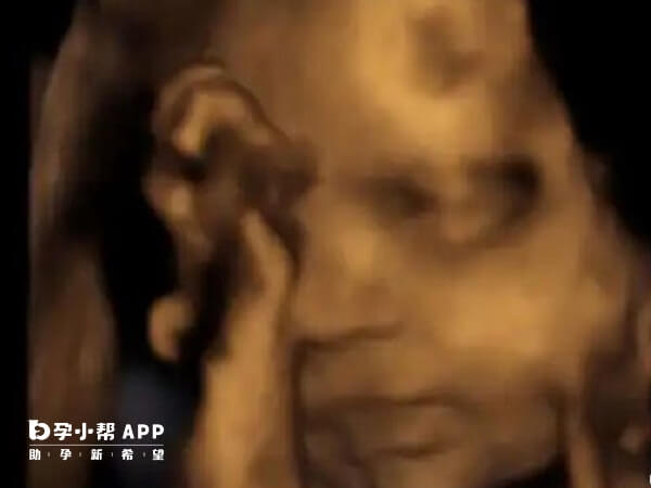 四维彩超胎儿手捂脸可能是体位问题