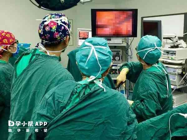 腹腔镜手术一般需要全身麻醉