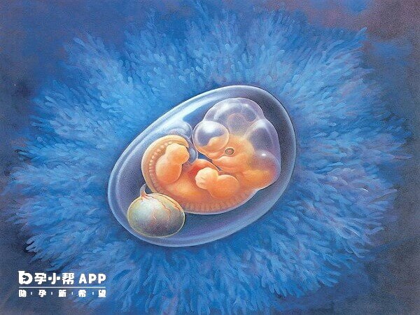 生化妊娠是指在妊娠5周内的早期流产