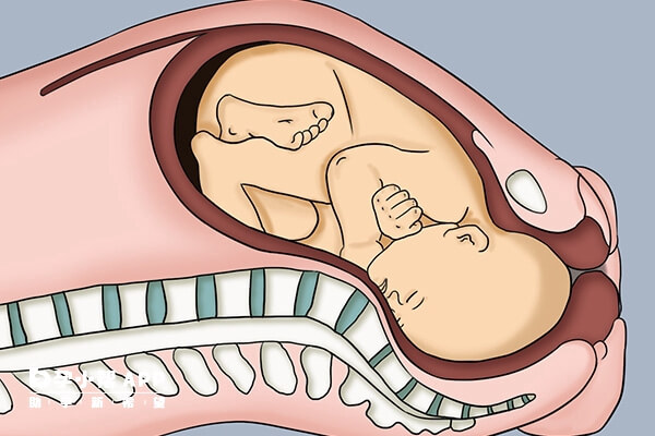 胎儿全入盆示意图