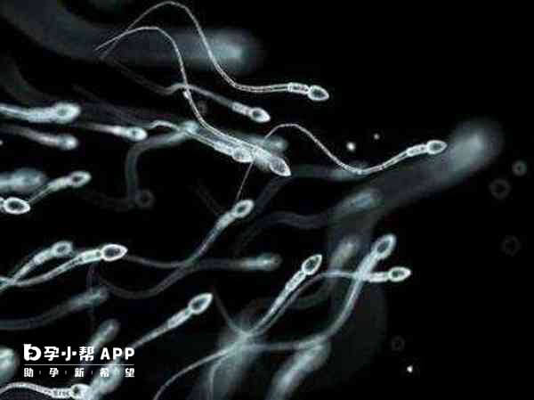 精液常规可以排查精子质量问题