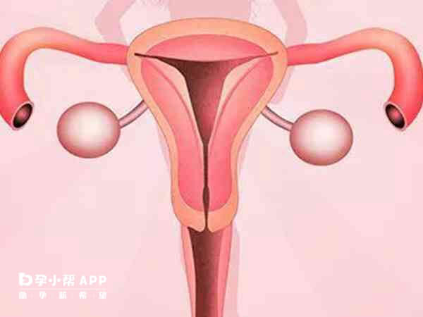 子宫内膜异位症会导致不孕不育