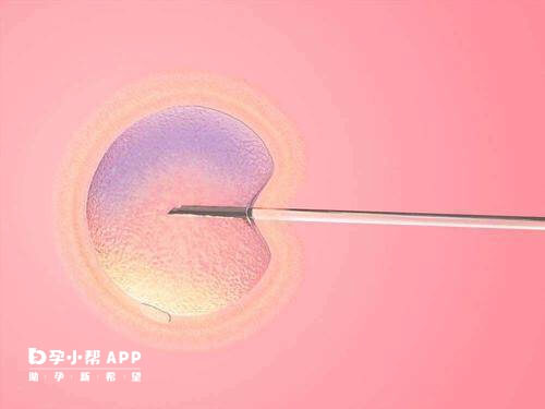 试管婴儿人工周期准备子宫内膜