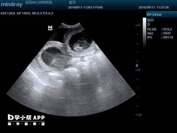 做b超不能空腹