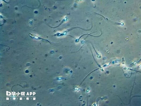 饮食清淡有利精子健康