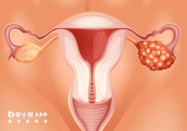 巢倍滋有改善女性内分泌的作用