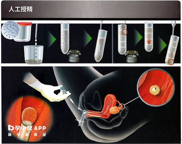 辽宁人工授精流程图