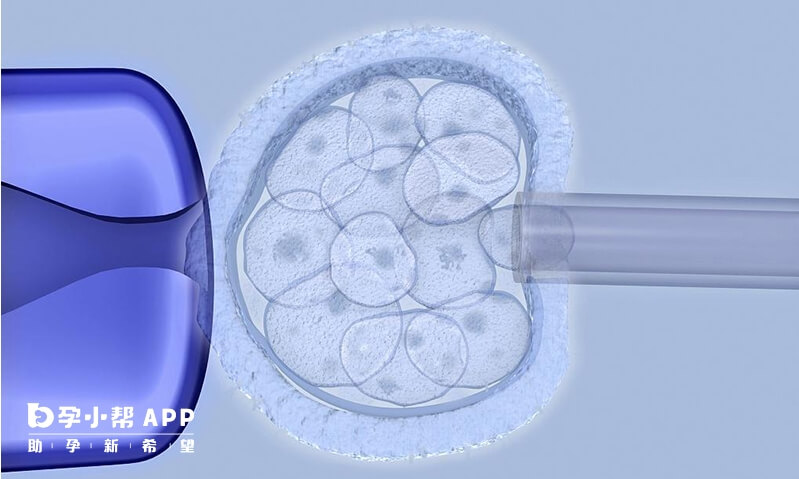 鲜胚移植周期短对女性身体负担小