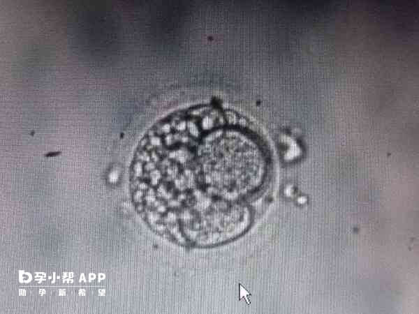 13细胞胚胎简称为13c胚胎