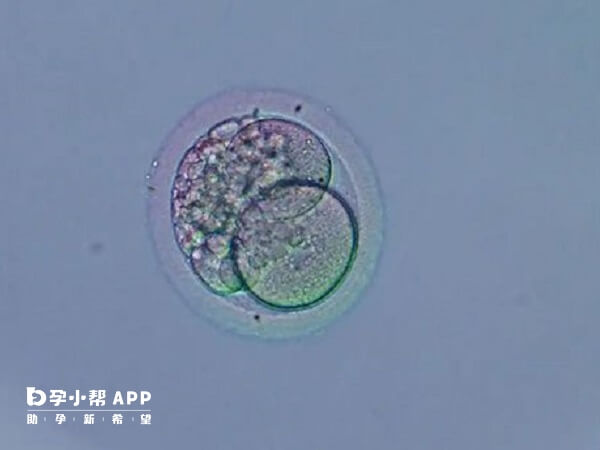 0pn囊胚是指受精时未见原核的胚胎