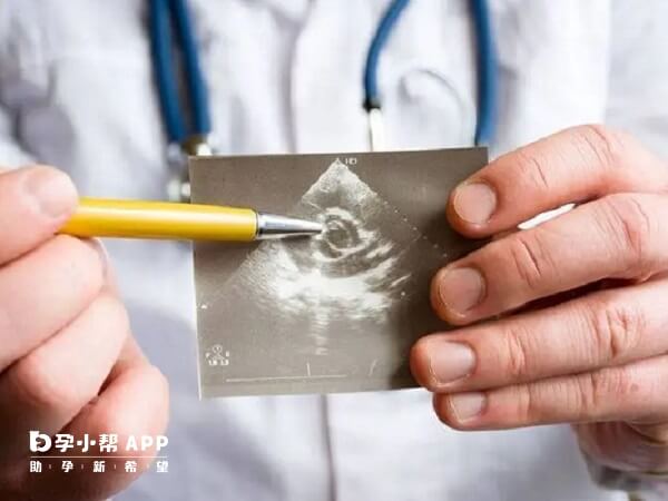 孕囊偏小可能是发育不良导致的
