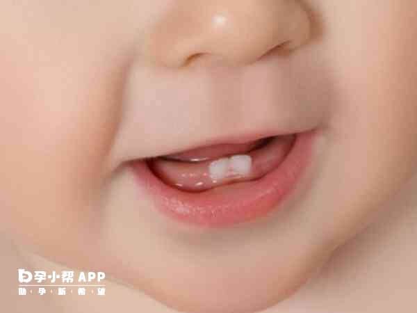 缺钙的宝宝长牙慢