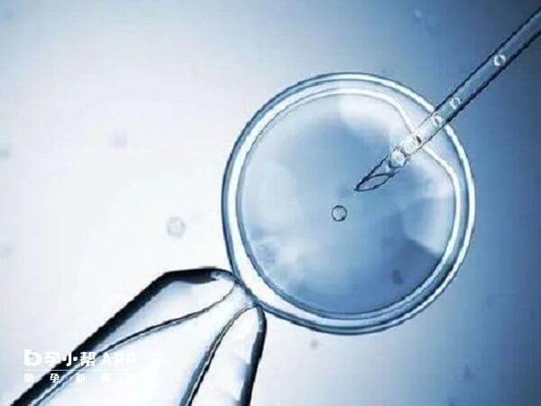 试管婴儿的精子和卵子都是经过筛选的