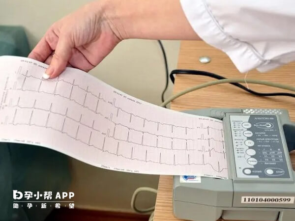 心电图检查主要是排除心脏方面疾病