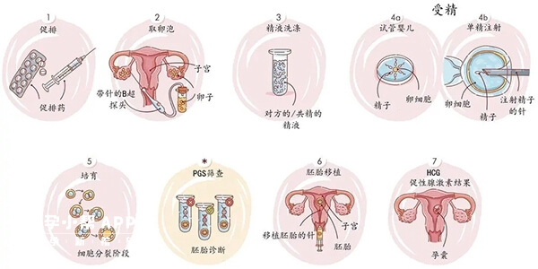 试管婴儿助孕流程图