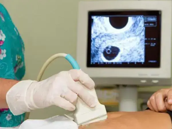 孕期做产检观察胎心胎芽很重要